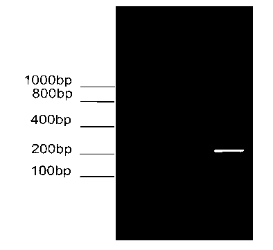 Preparation method of carp amino acid transporter transport subunit rBAT rabbit anti-antiserum