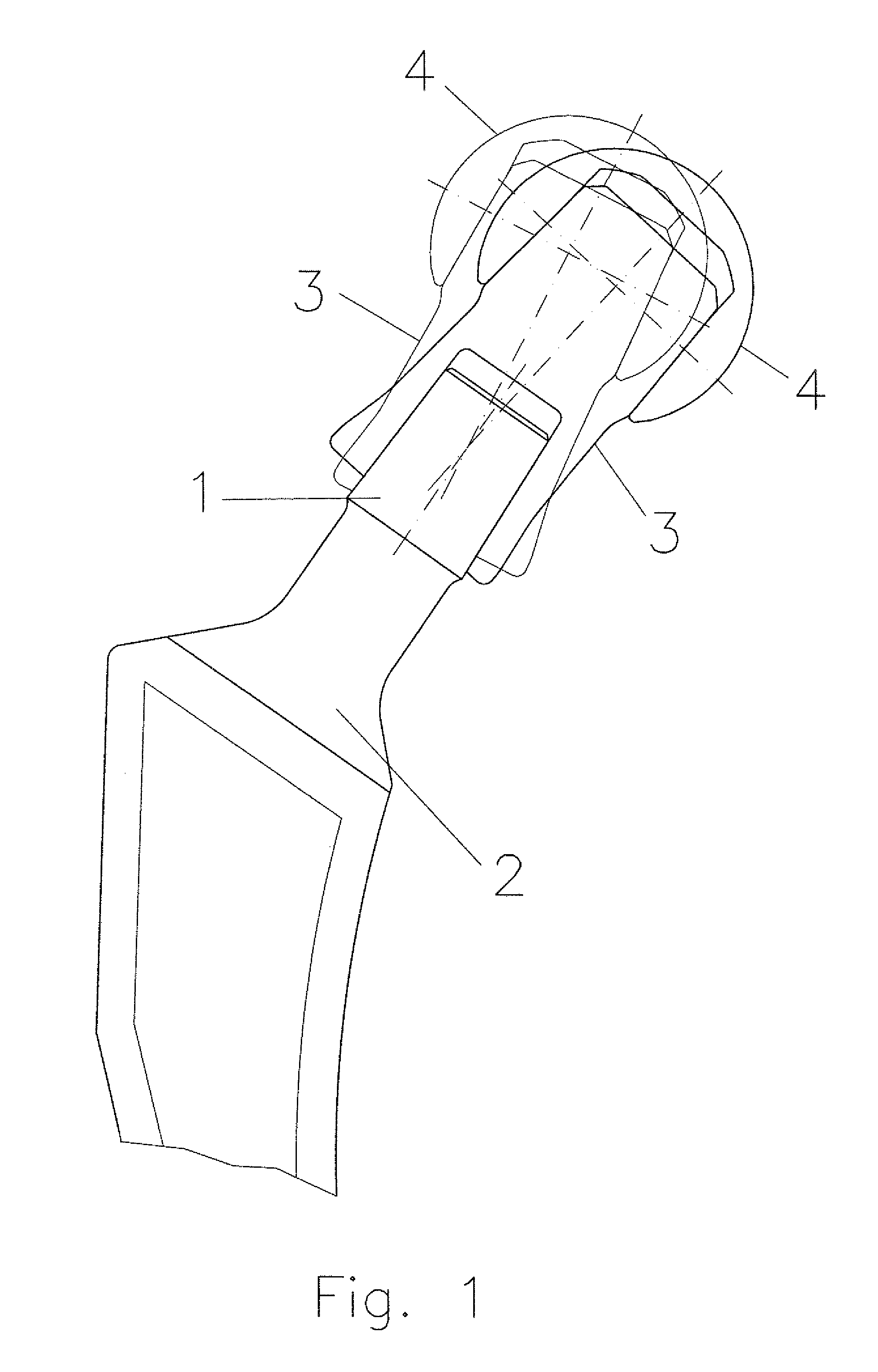 Modular Joint Prosthesis System, Premounted Joint Prosthesis System Part and Sterile Article