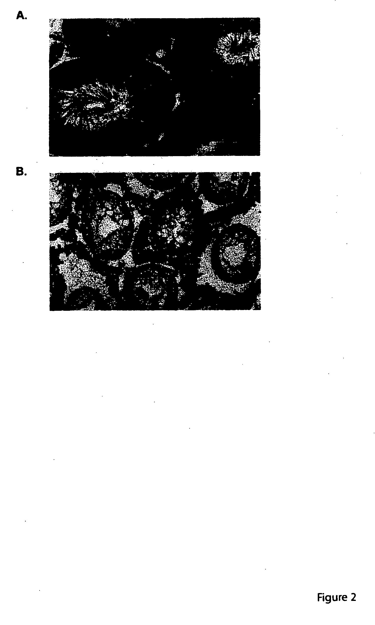 Methods for diagnosing epigenetic, transgenerational effects of environmental toxicants on mammalian germ-lines and treating associated diseases