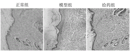 Traditional Chinese medicine composition for promoting healing of diabetic wounds