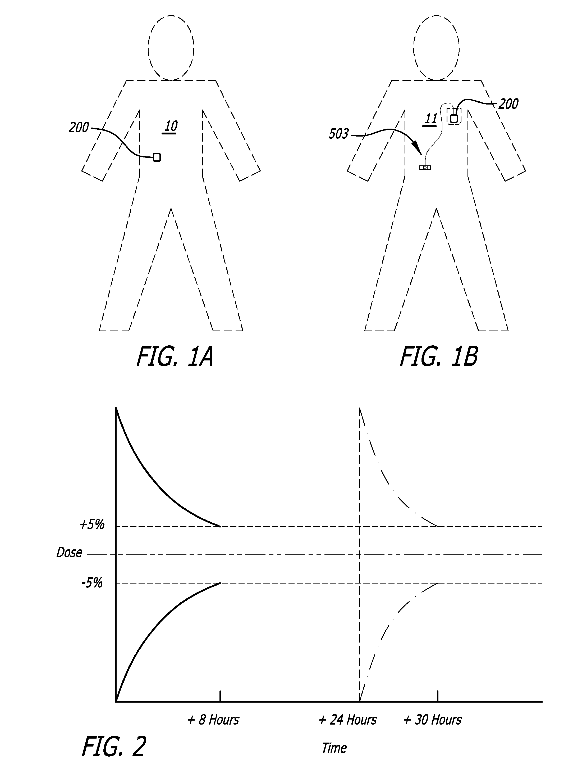 Infusion pumps