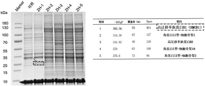 Nucleic acid aptamers targeting and antagonizing HMGB1 molecules