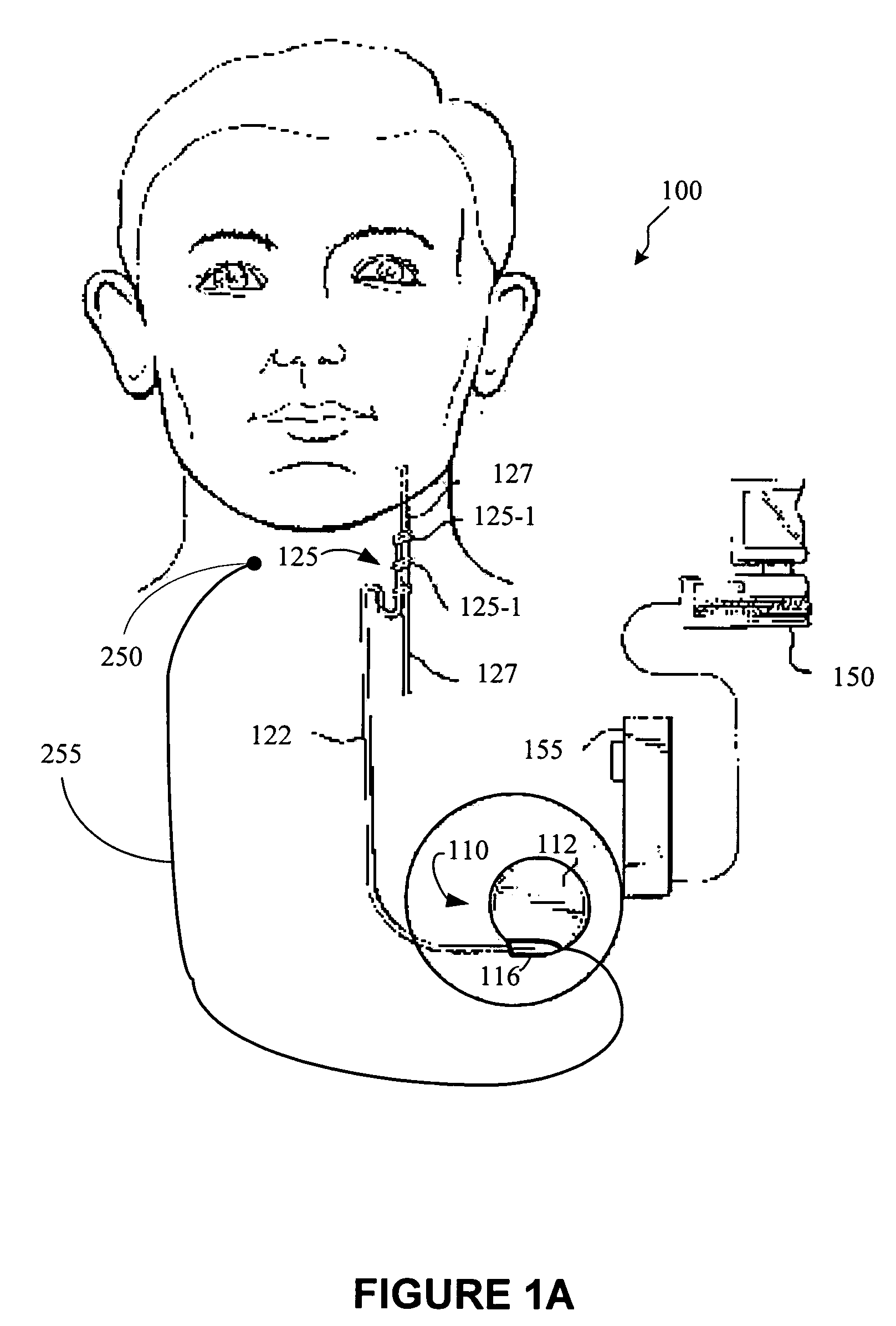 Variable output ramping for an implantable medical device