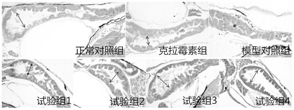 Food composition for resisting helicobacter pylori