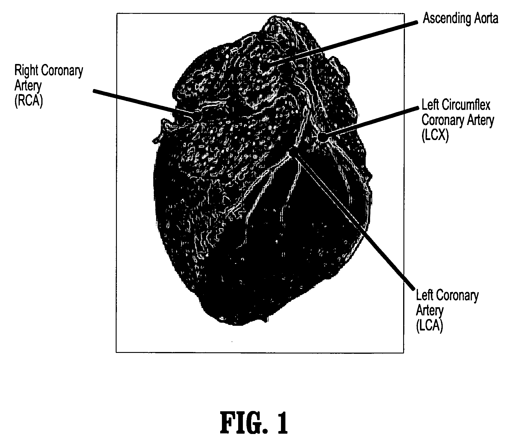 System and method for coronary artery segmentation of cardiac CT volumes