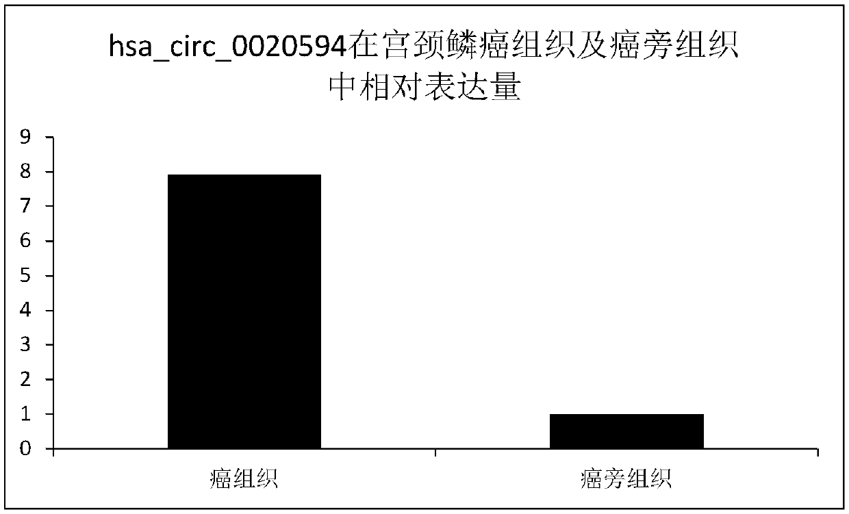 Cervical cancer molecular marker and application thereof