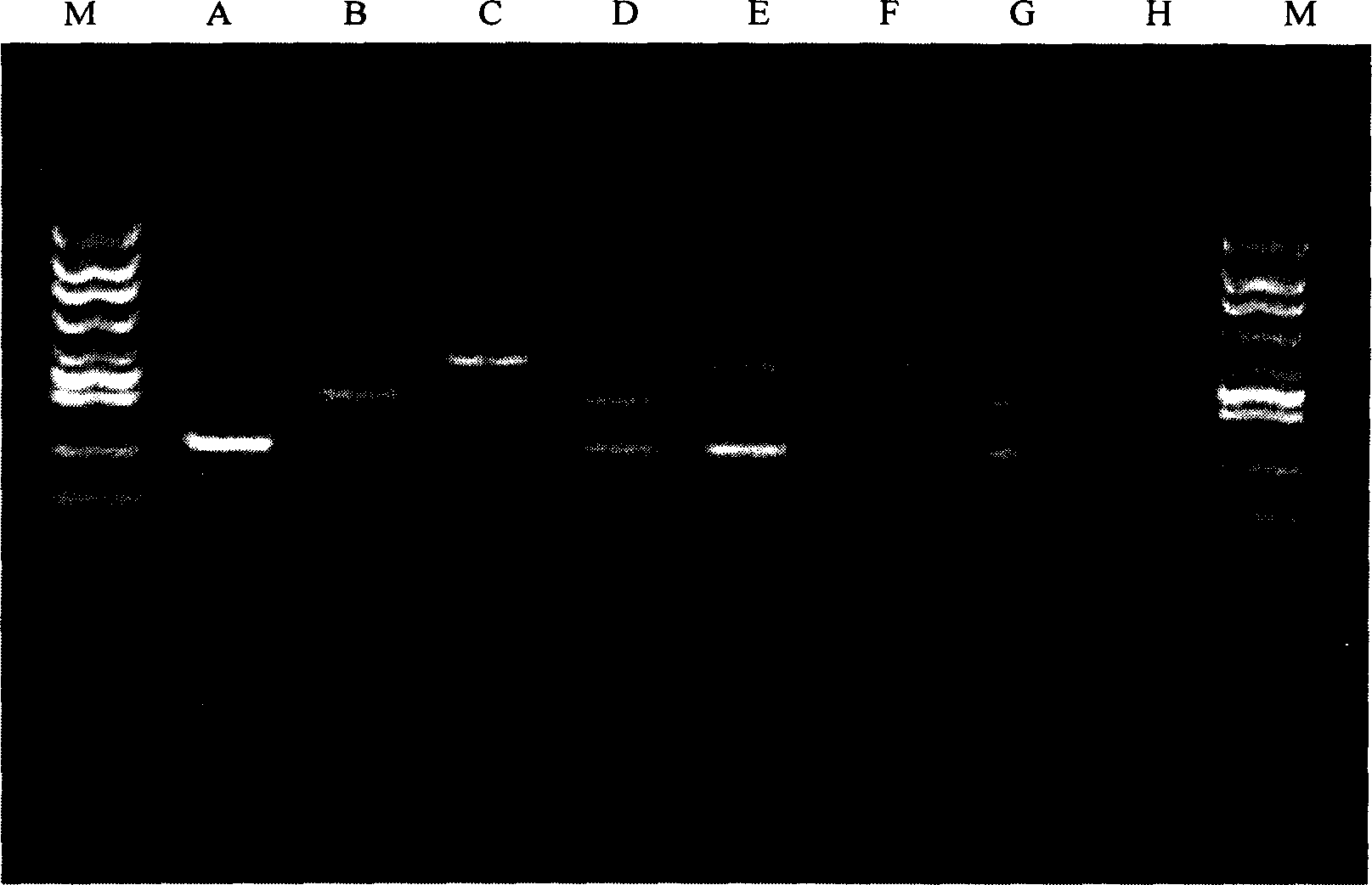 Kit for diagnosing gene of Leber optic neuropathy in heredity and detecting method