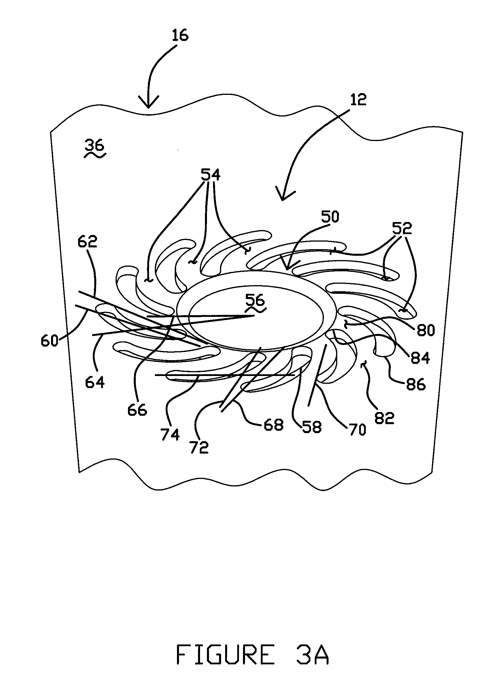 Deep dimple structure for head suspension component