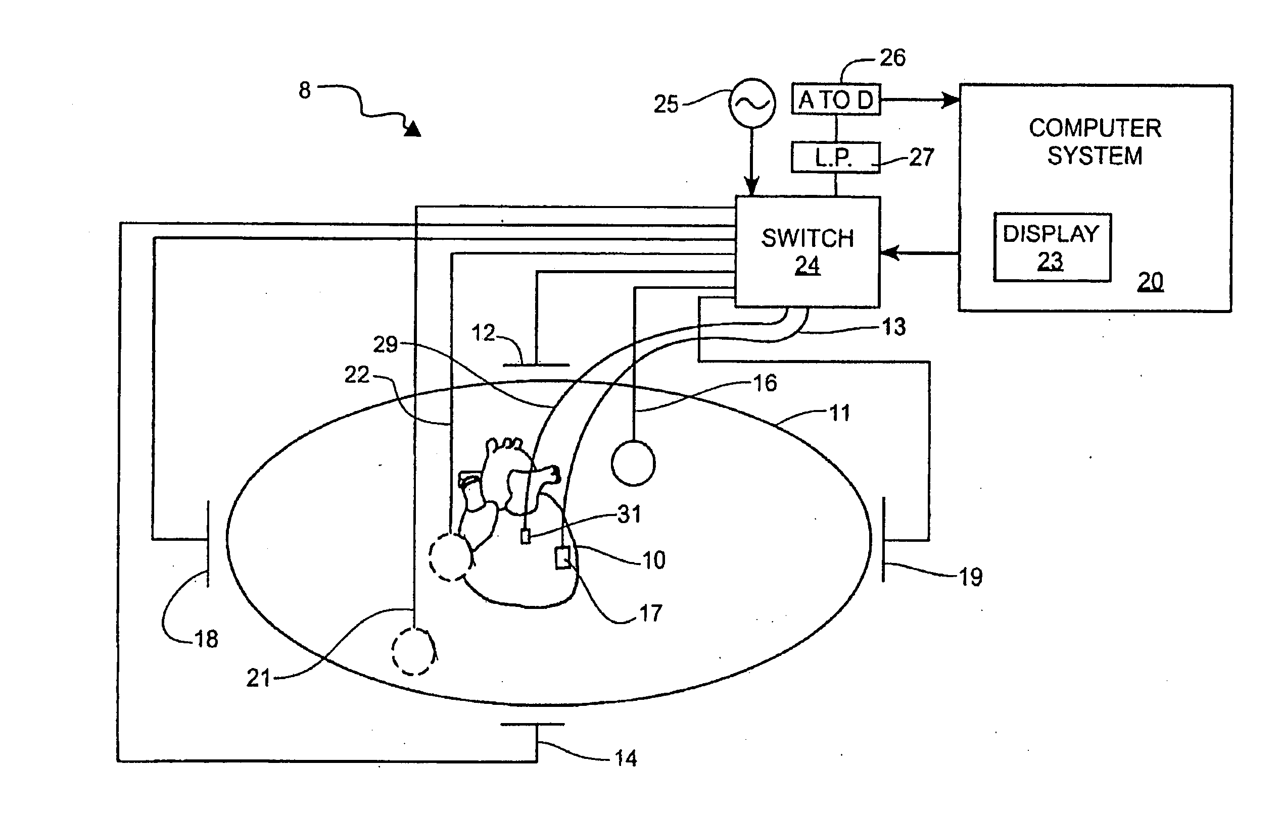 System and method for mapping complex fractionated electrogram information