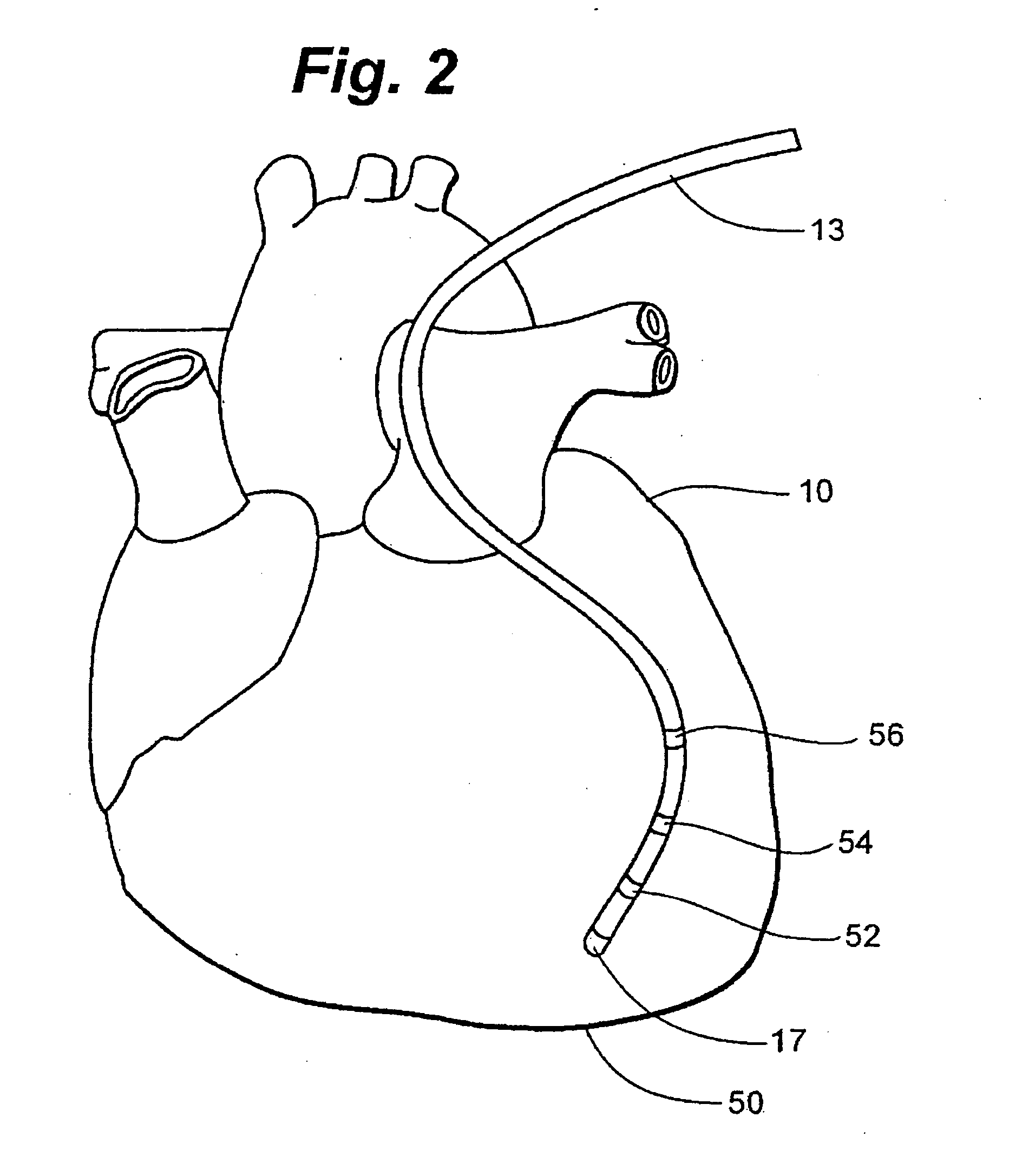 System and method for mapping complex fractionated electrogram information