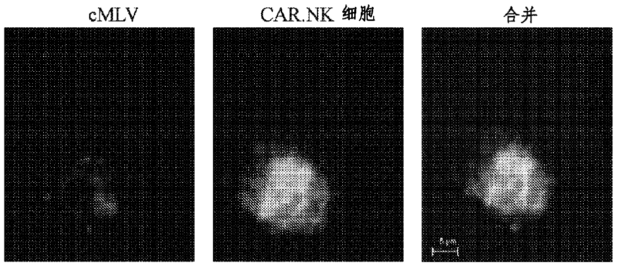 Combination cancer therapy using chimeric antigen receptor engineered natural killer cells as chemotherapeutic drug carriers