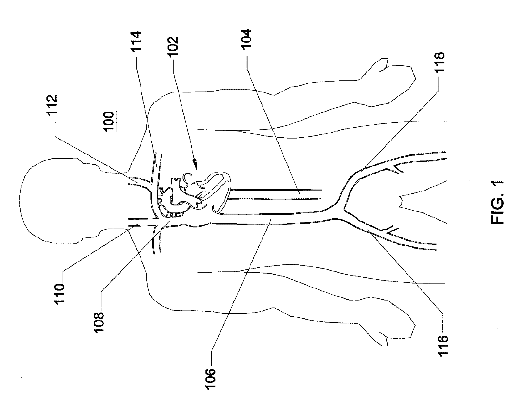 Expandable trans-septal sheath