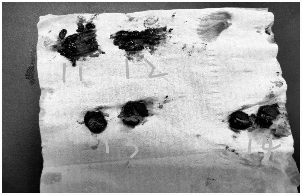 Deer blood buccal tablet and preparation method thereof