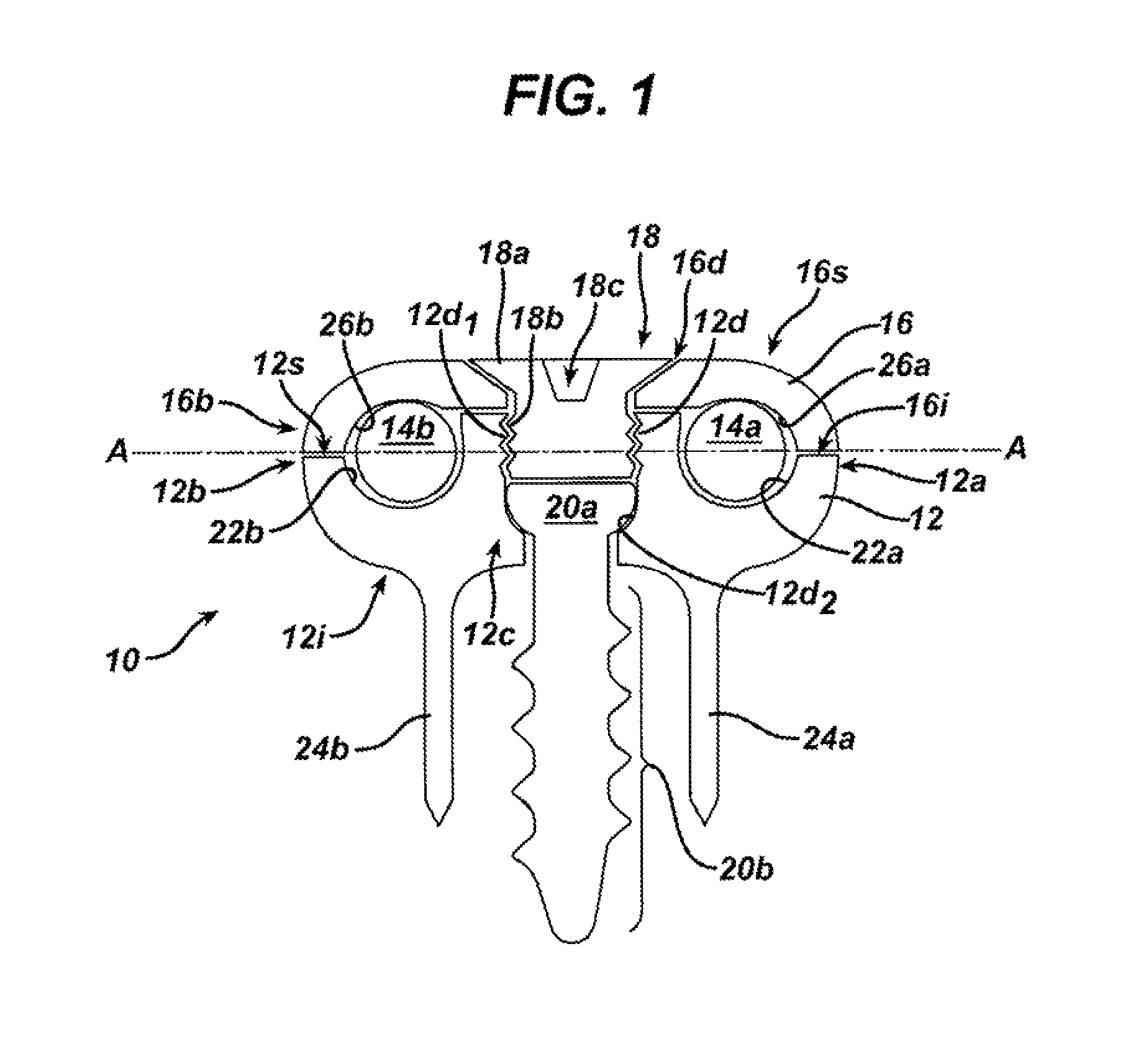 Non-fusion spinal correction systems and methods