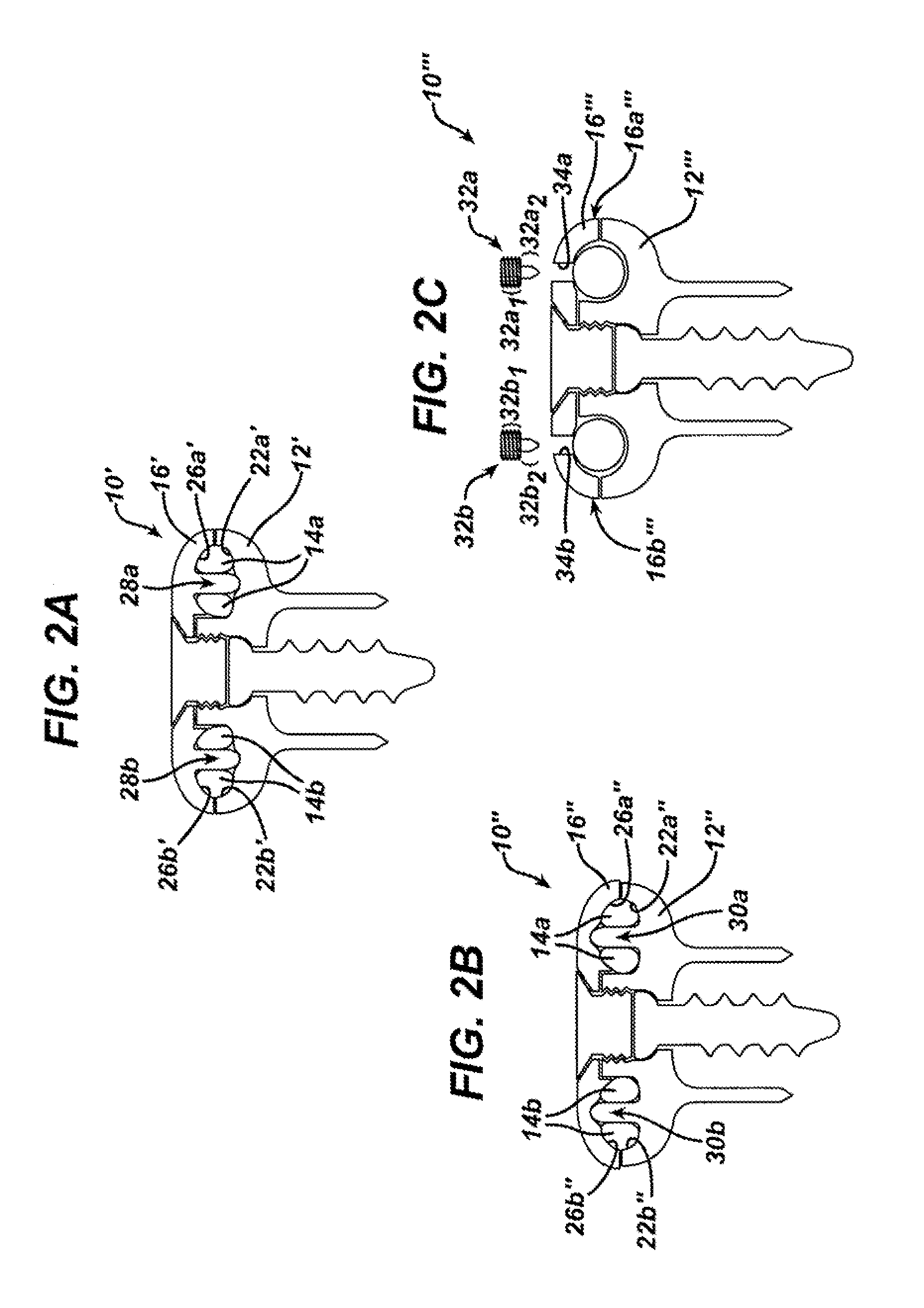 Non-fusion spinal correction systems and methods