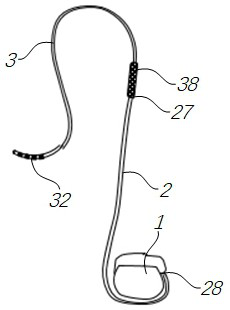 Implanted electrode and implanted electrical stimulation system