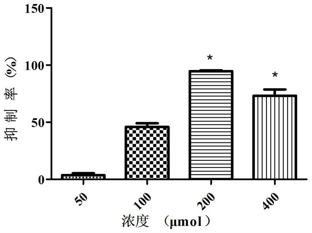 Application of a kind of teriflunomide in preparation of medicine for preventing foot-and-mouth disease virus infection