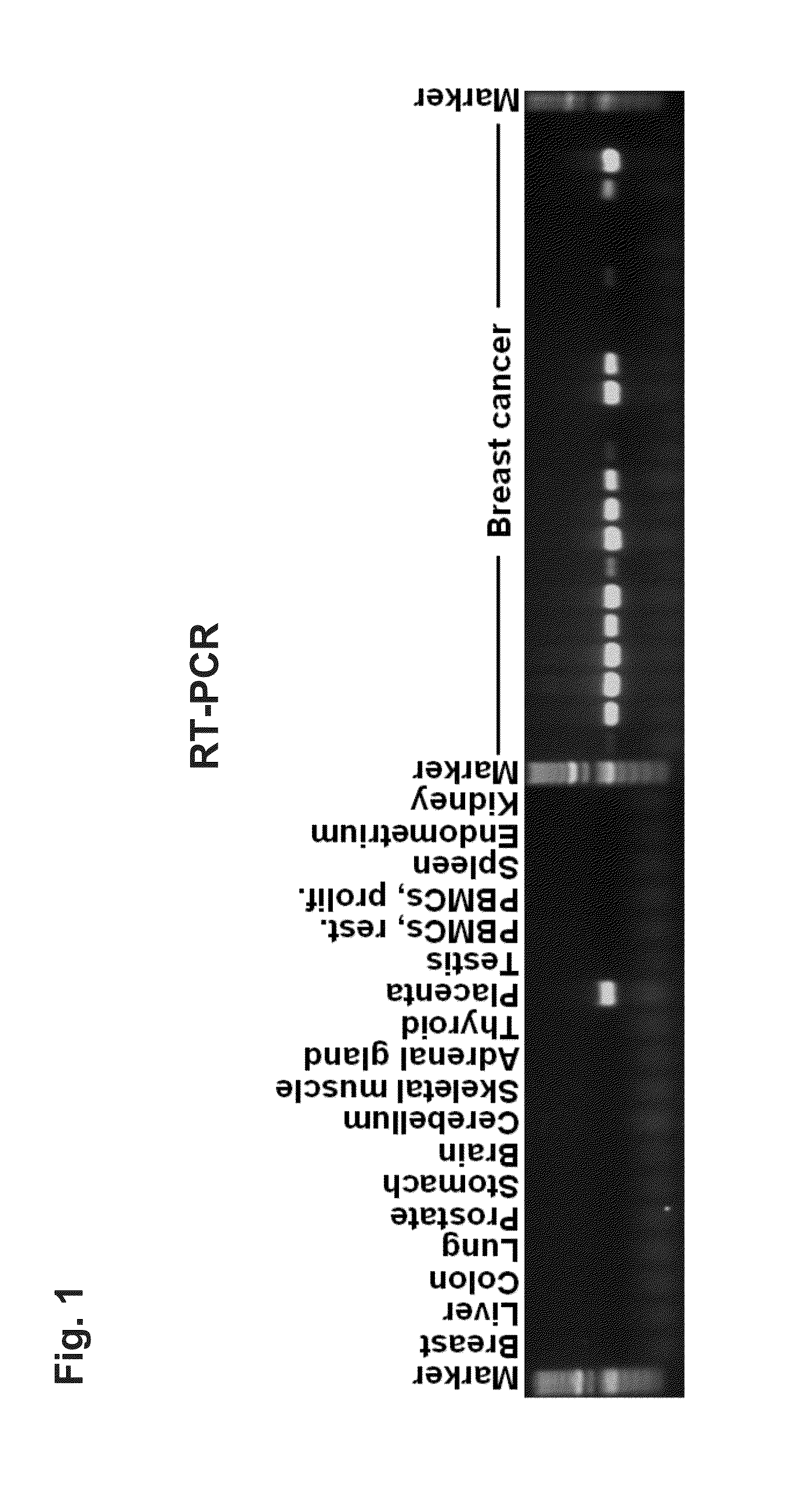 Identification of Tumor-Associated Markers for Diagnosis and Therapy