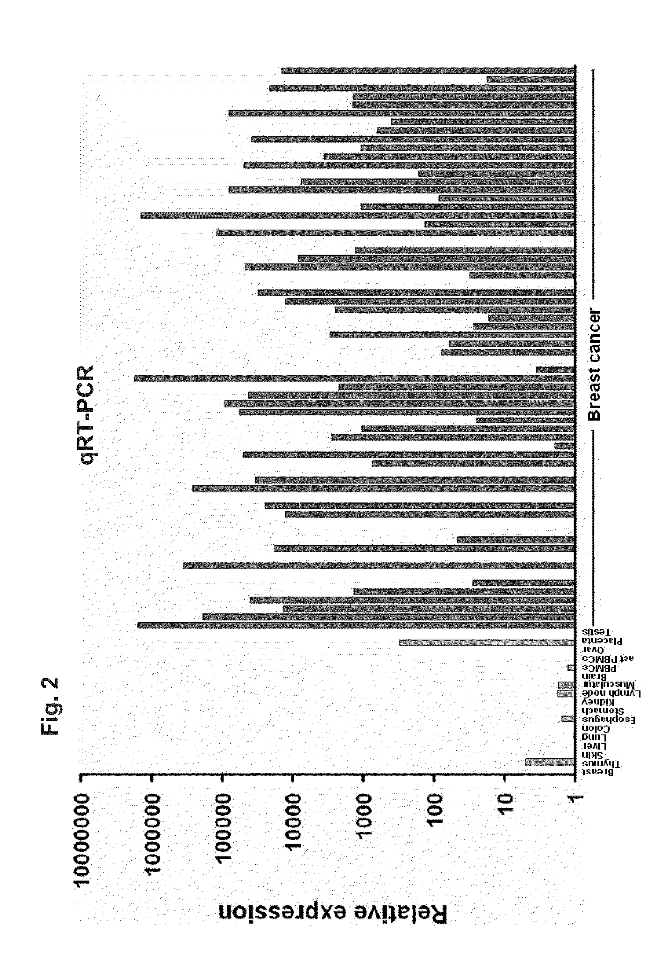 Identification of Tumor-Associated Markers for Diagnosis and Therapy