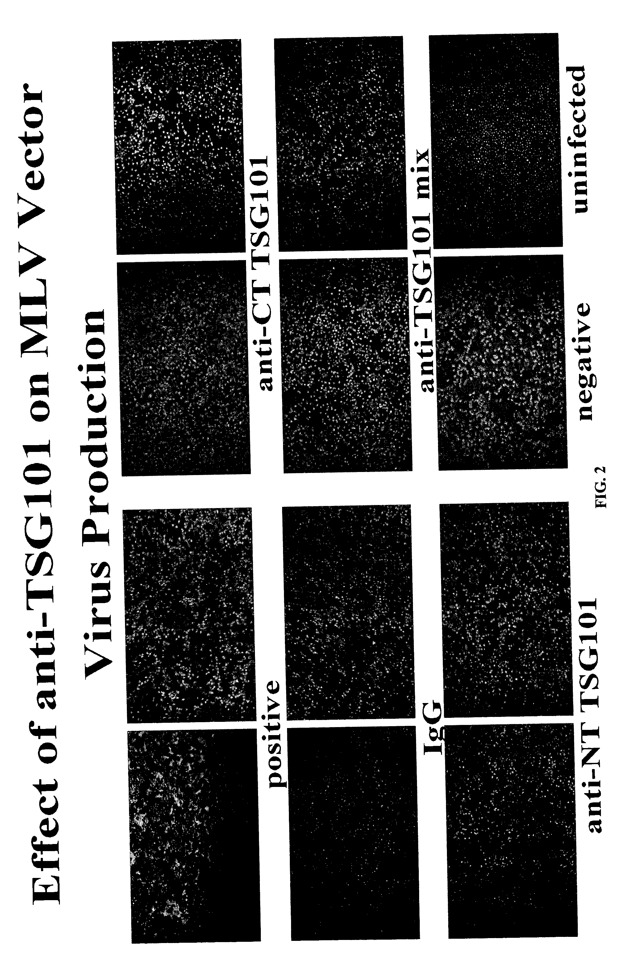 Anti-TSG101 antibodies and their uses for treatment of viral infections