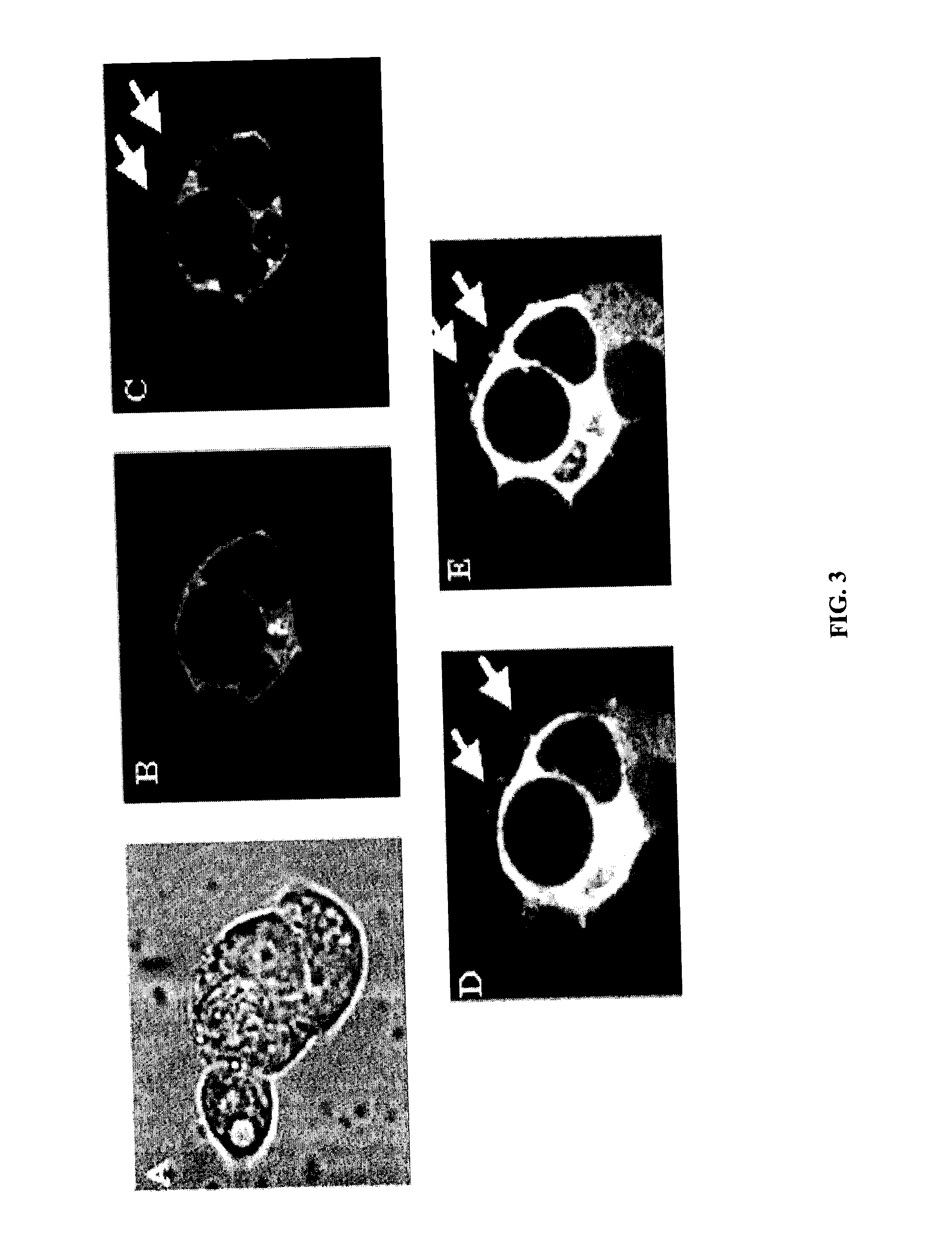 Anti-TSG101 antibodies and their uses for treatment of viral infections