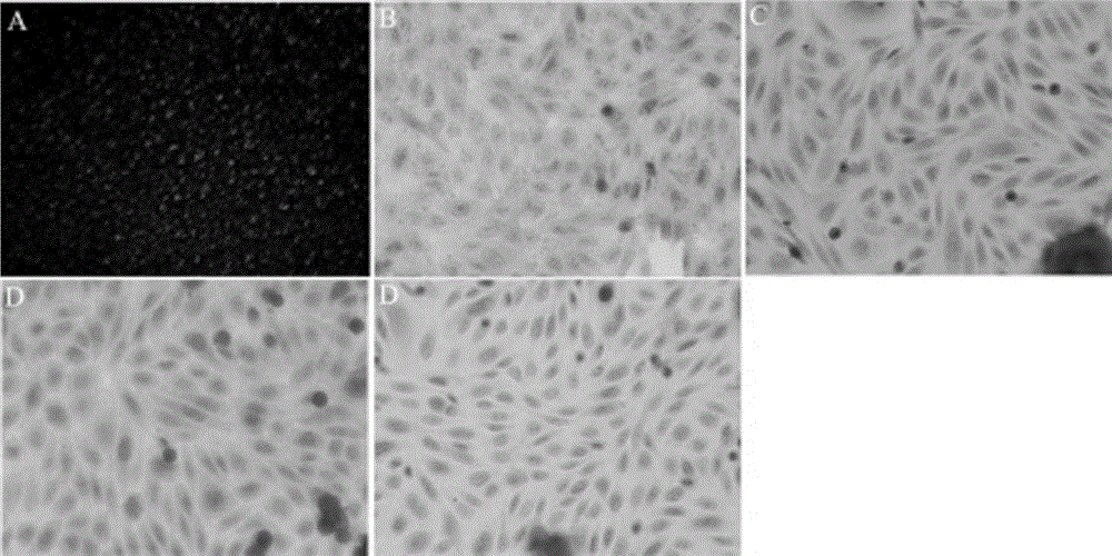 Small interfering ribonucleic acid (siRNA) capable of interfering alpaca melanin cell CDK5 gene expression, expression plasmid and application thereof