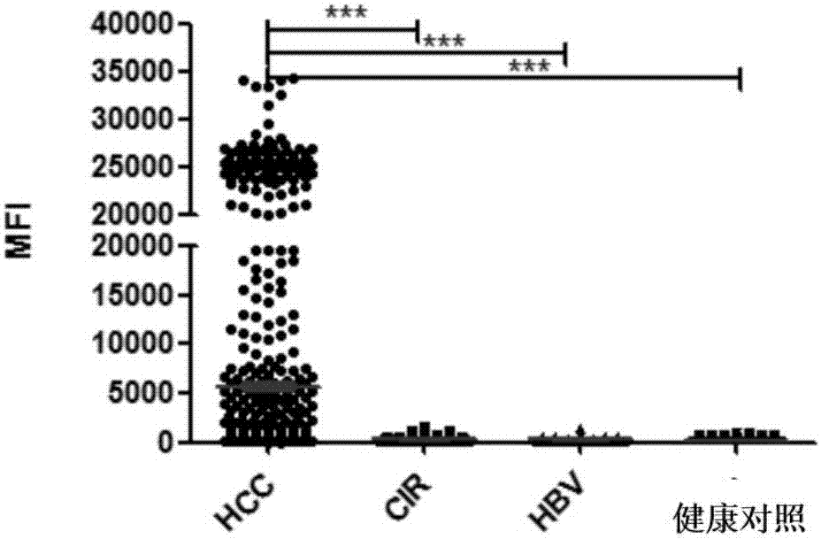 Use of serum markers containing alpha fetal protein (AFP), Golgi protein 73 (GP73) and carcinoembryonic antigen associated cell adhesion molecule 1 (CEACAM1) in diagnosis of liver diseases