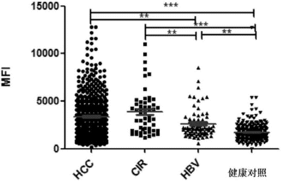 Use of serum markers containing alpha fetal protein (AFP), Golgi protein 73 (GP73) and carcinoembryonic antigen associated cell adhesion molecule 1 (CEACAM1) in diagnosis of liver diseases