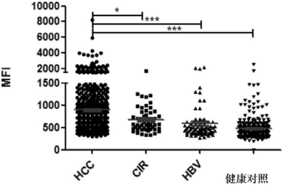 Use of serum markers containing alpha fetal protein (AFP), Golgi protein 73 (GP73) and carcinoembryonic antigen associated cell adhesion molecule 1 (CEACAM1) in diagnosis of liver diseases