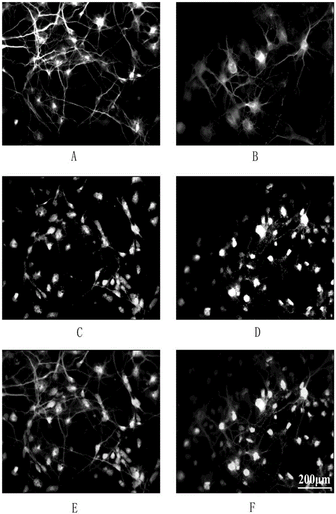 Culturing method of chick embryo forebrain neuron