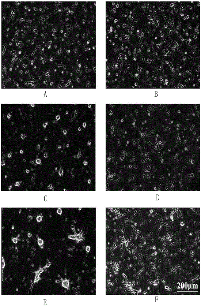 Culturing method of chick embryo forebrain neuron