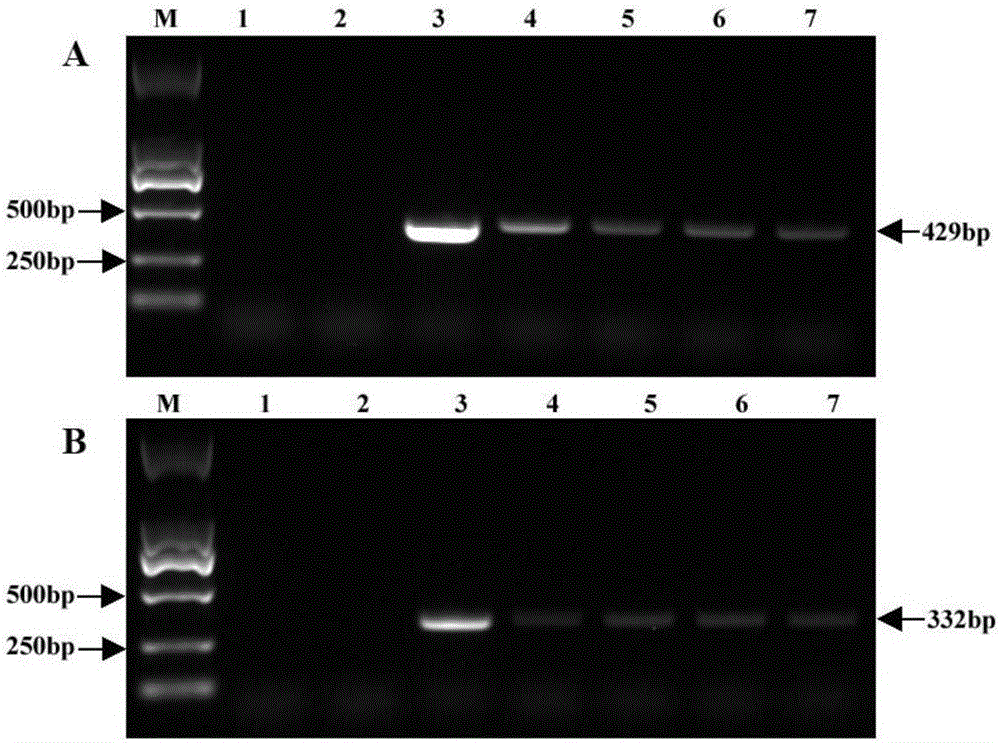 Preparation method of antivirus and inactivated yeast engineered strains