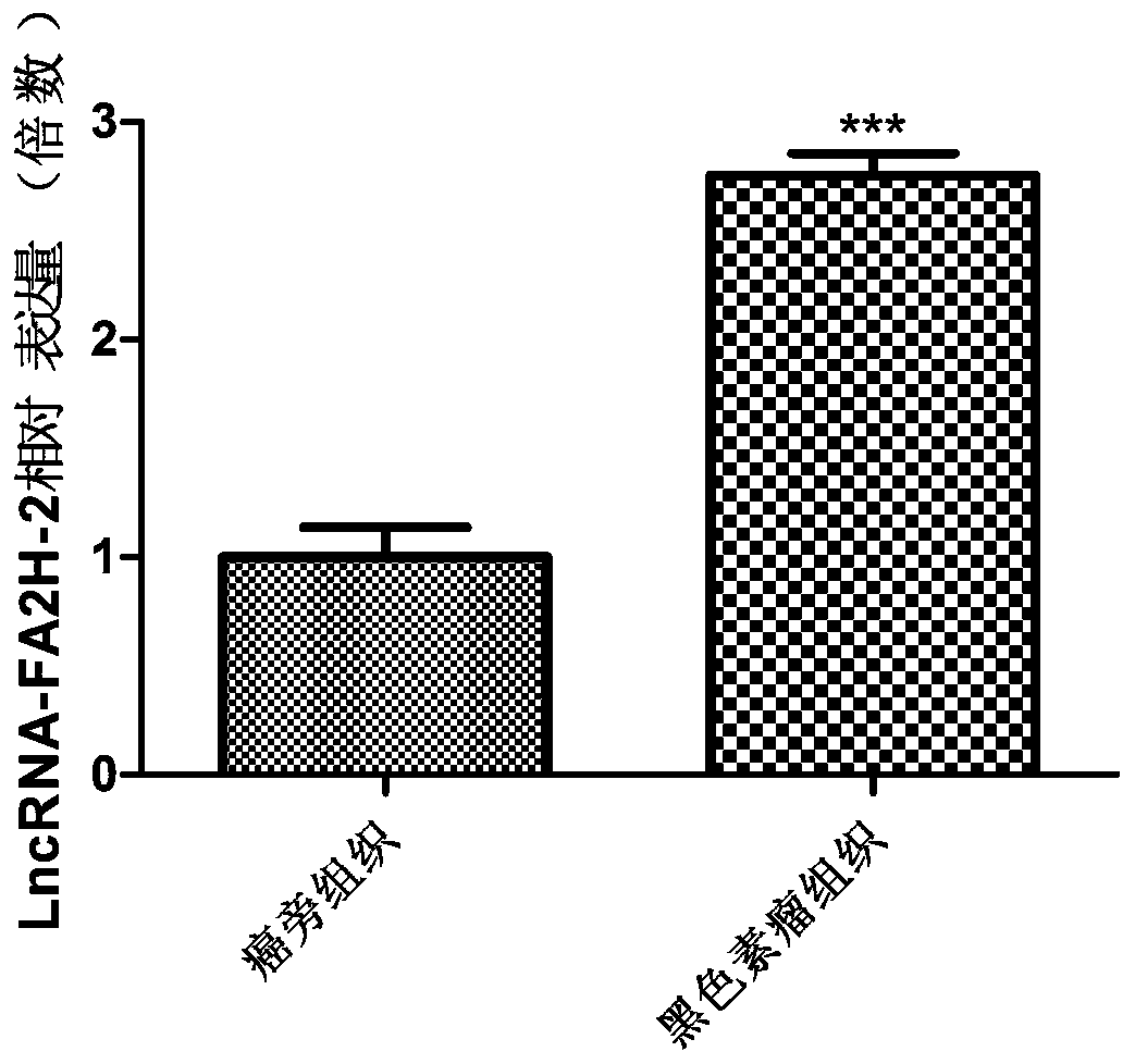 Long non-coding RNA related to melanoma and application thereof