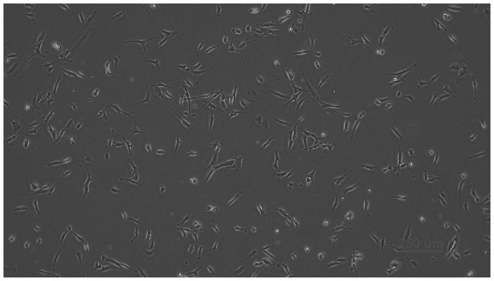 A human chondroblastoma cell line and its application