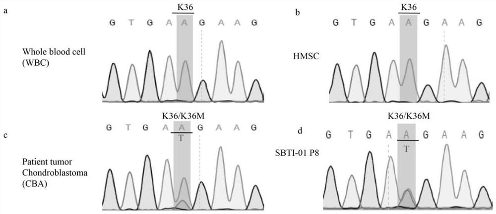 A human chondroblastoma cell line and its application