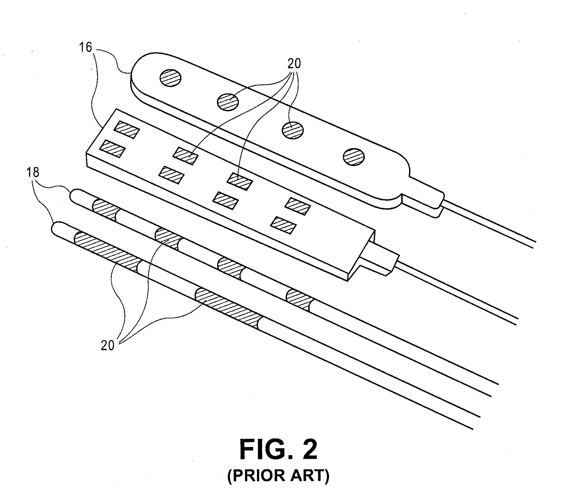 Expandable stimulation leads and methods of use