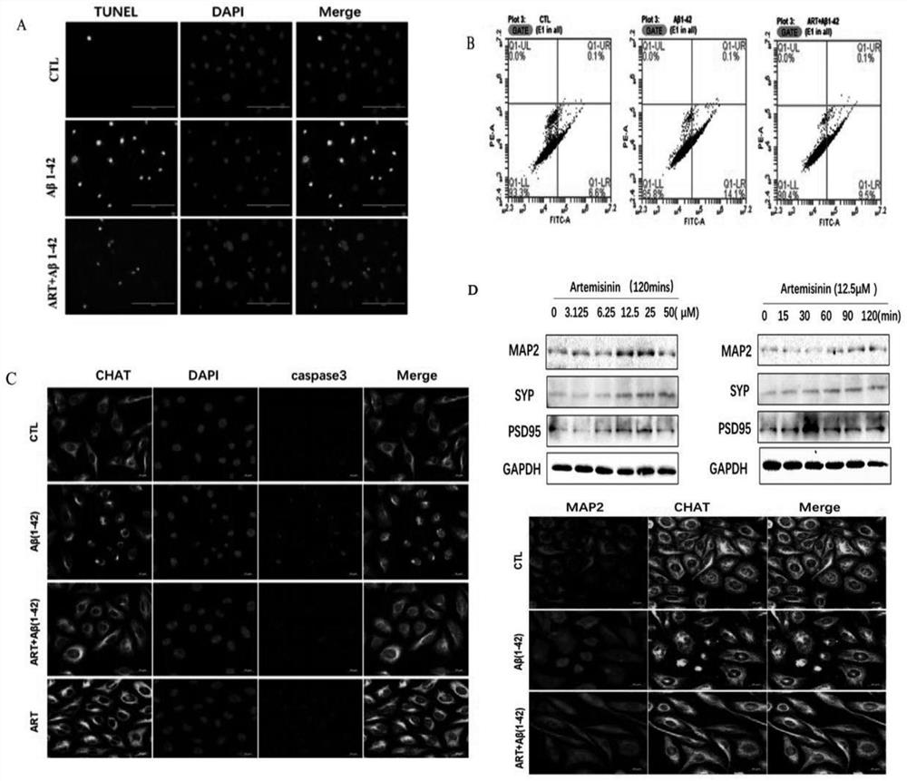 Application of artemisinin and derivatives thereof in preparation of ChAT activity enhancer