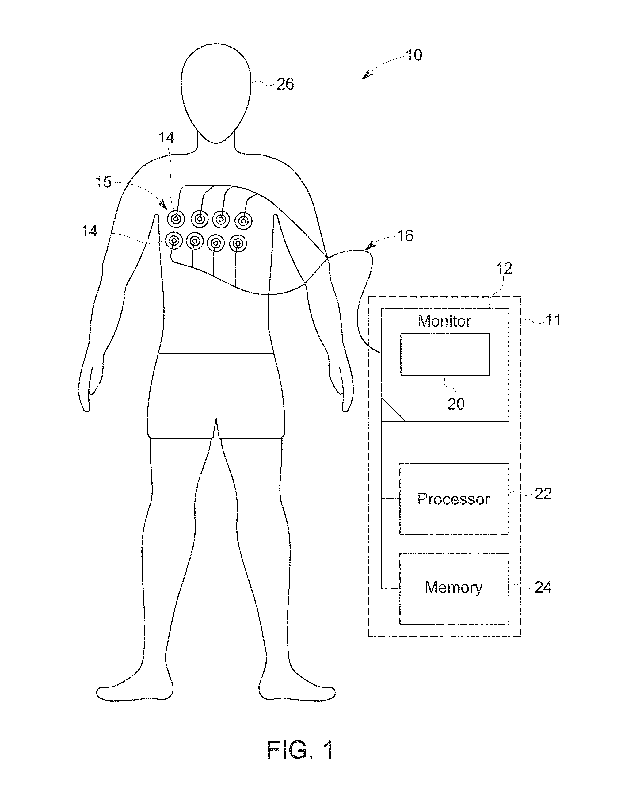 Systems and methods for soft-field tomography