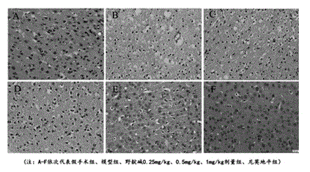 Application of cytisine in medicines for treating cerebral arterial thrombosis