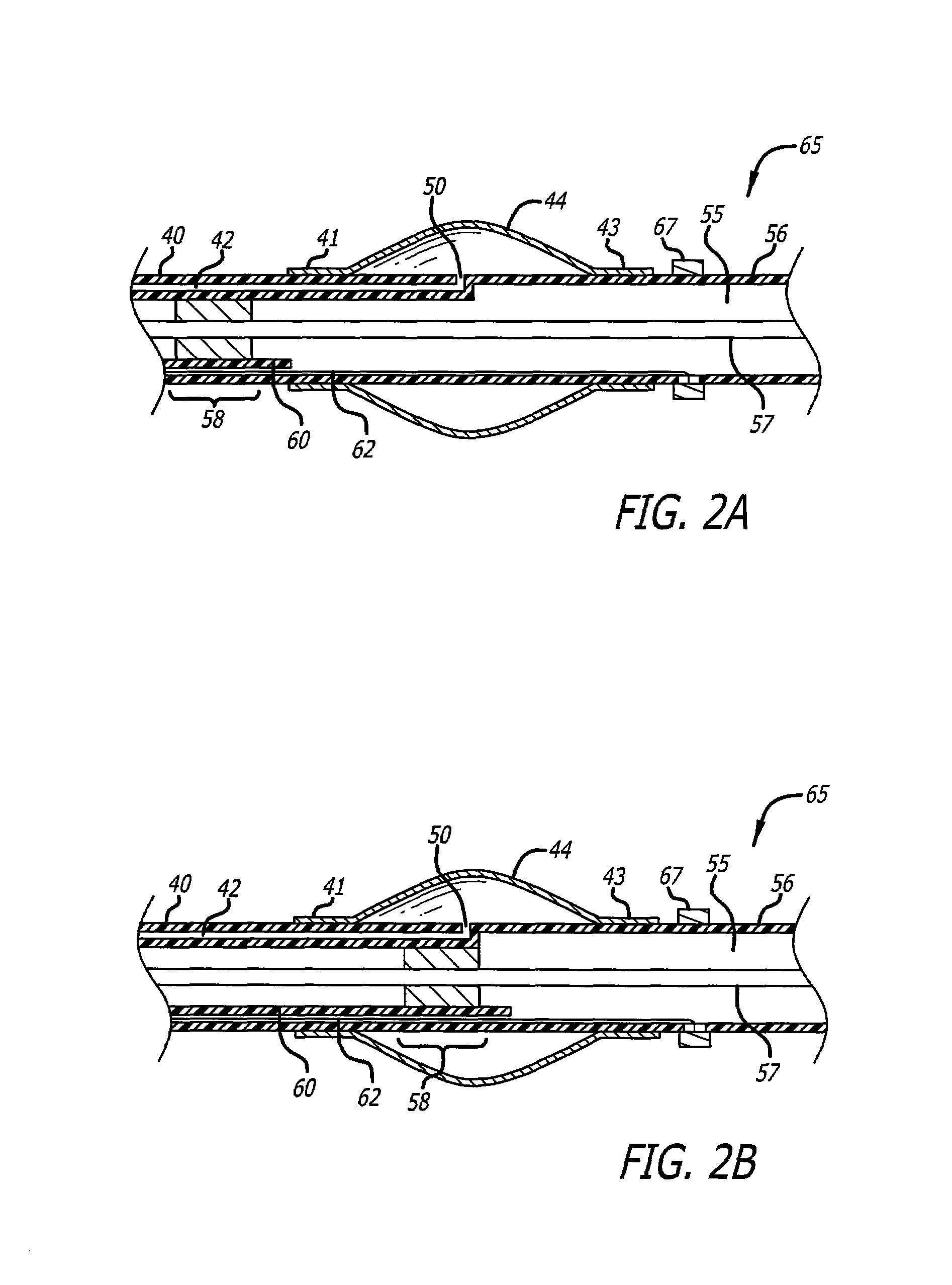 Long nose manipulatable catheter