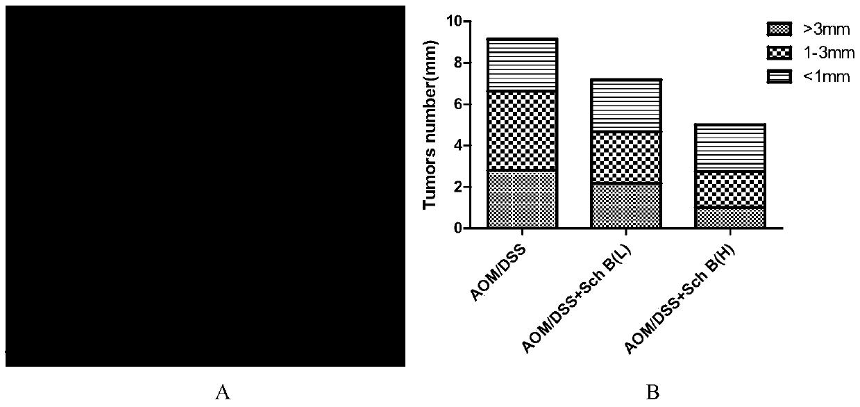 Application of schisandrin B in preparation of drugs for preventing colitis or colon cancer