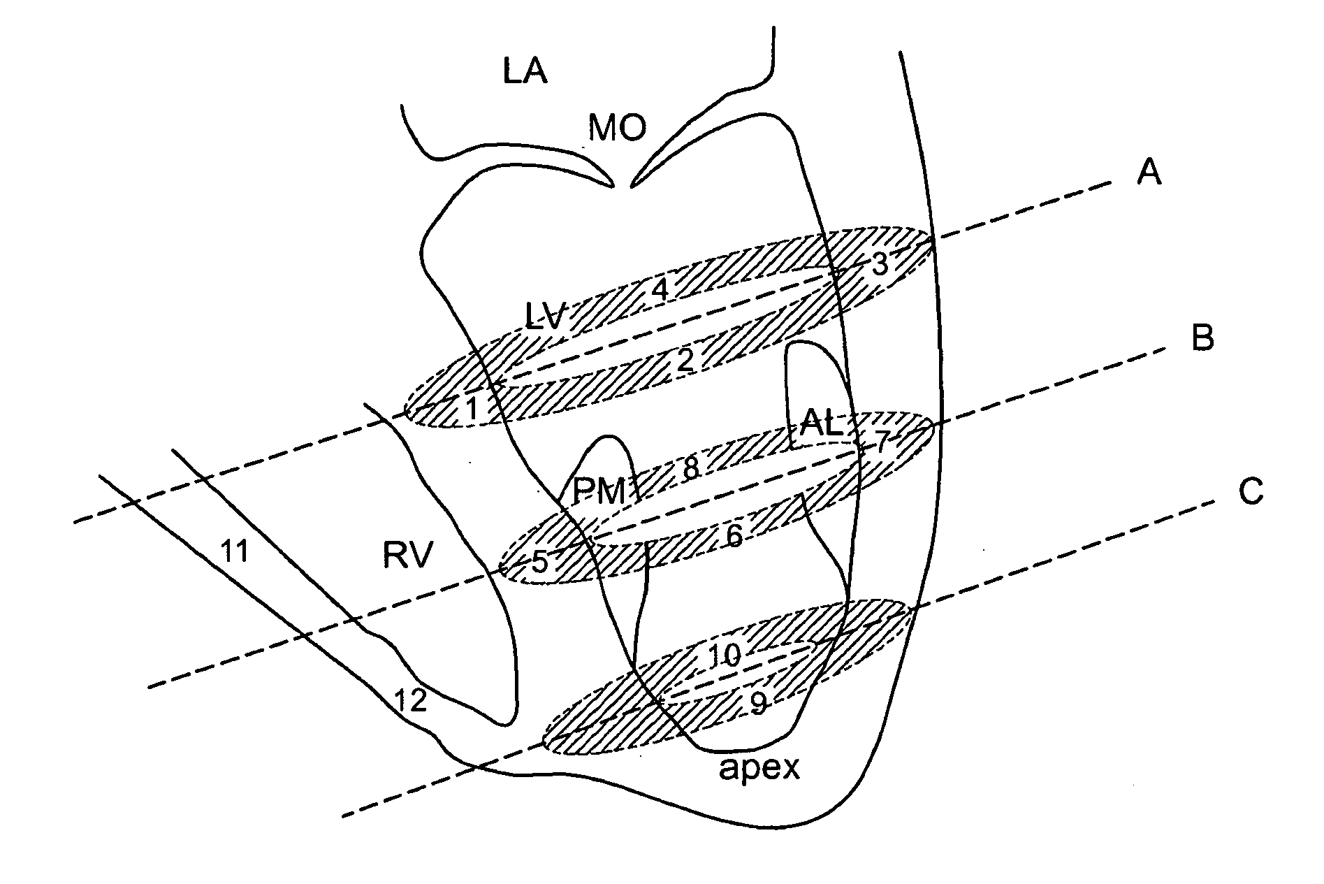 Method for enhanced uptake of viral vectors in the myocardium