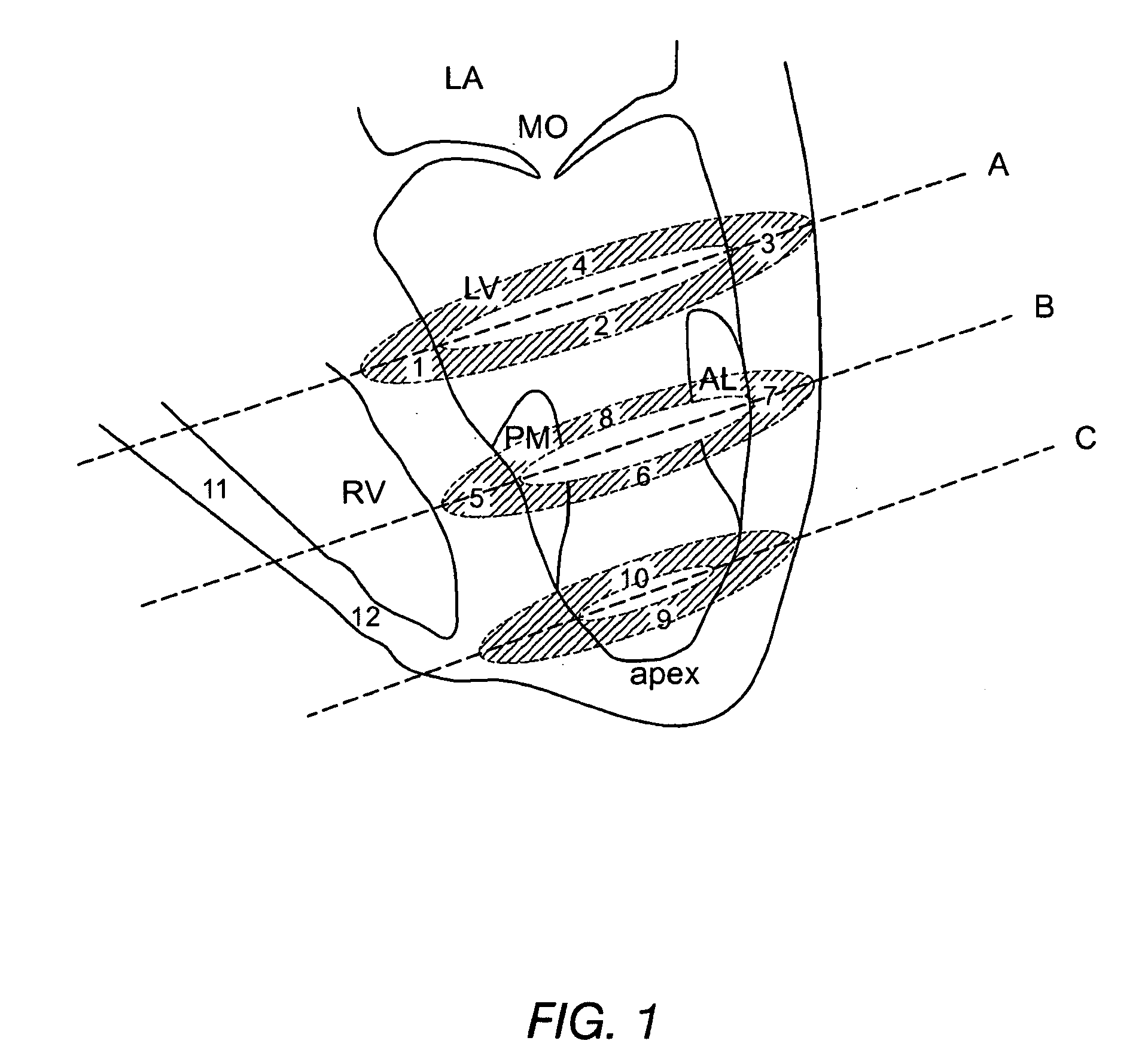 Method for enhanced uptake of viral vectors in the myocardium