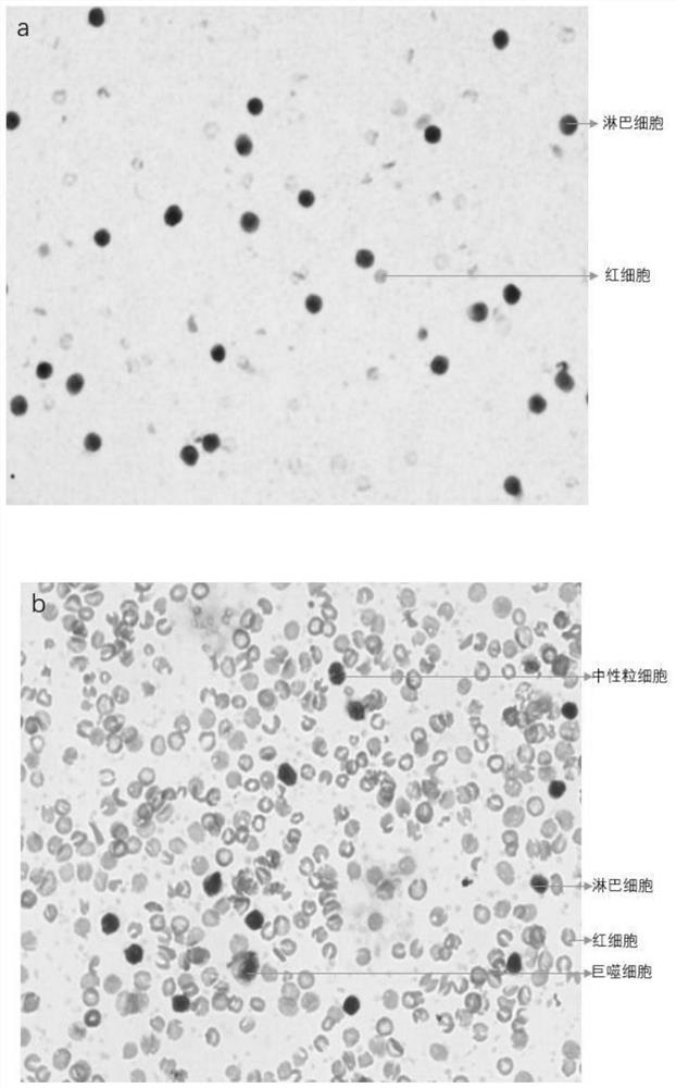 Separation method of tree shrew peripheral blood mononuclear cells