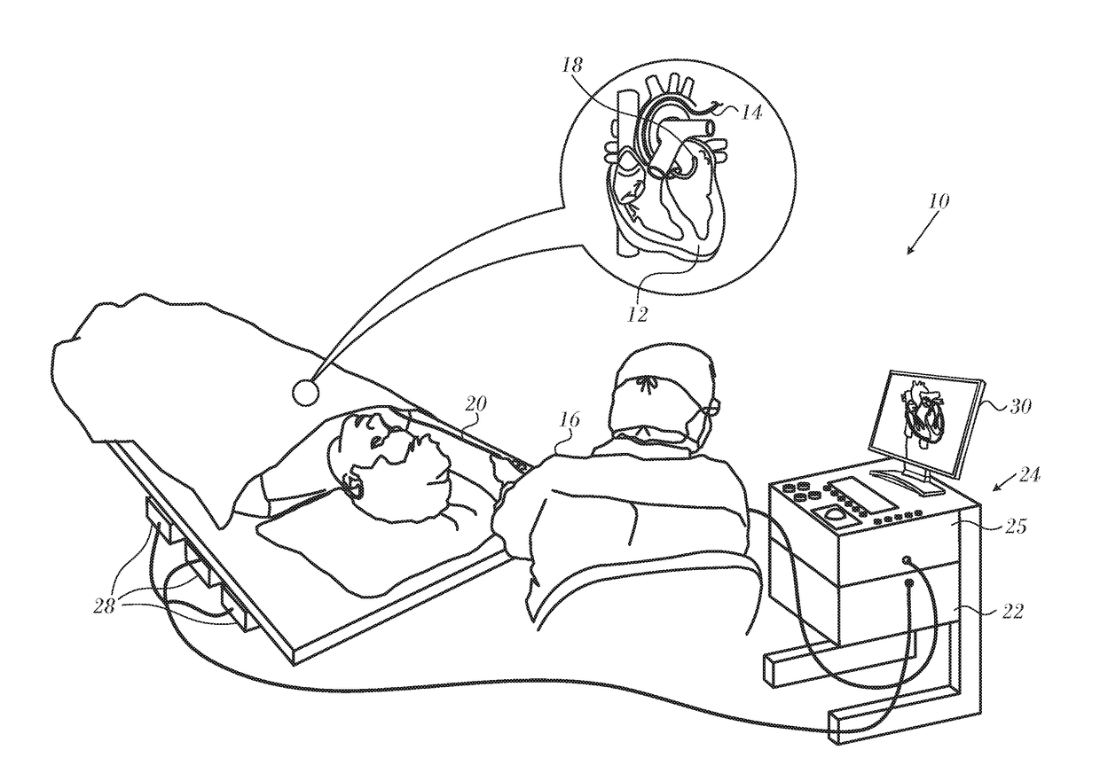 Temperature measurement in catheter