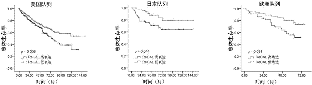 Prognostic evaluation biomarker for kidney cancer as well as detection reagent and application thereof