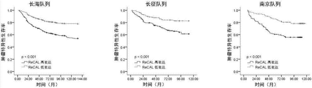 Prognostic evaluation biomarker for kidney cancer as well as detection reagent and application thereof