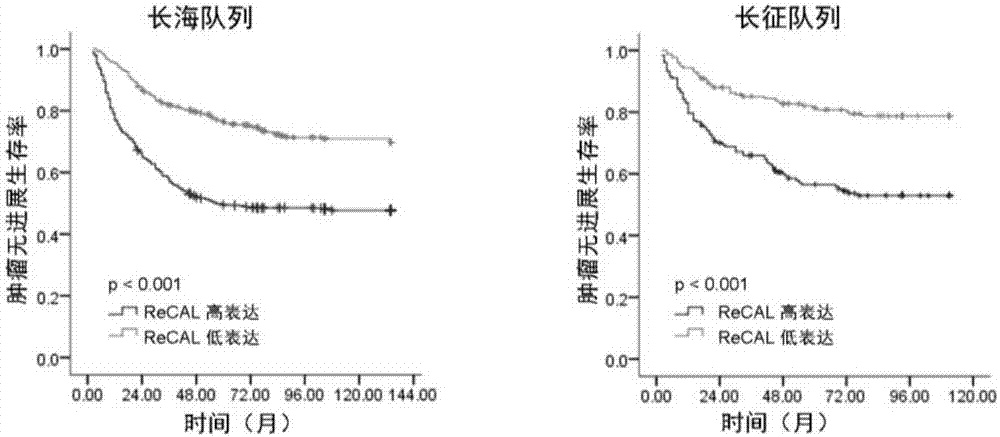 Prognostic evaluation biomarker for kidney cancer as well as detection reagent and application thereof