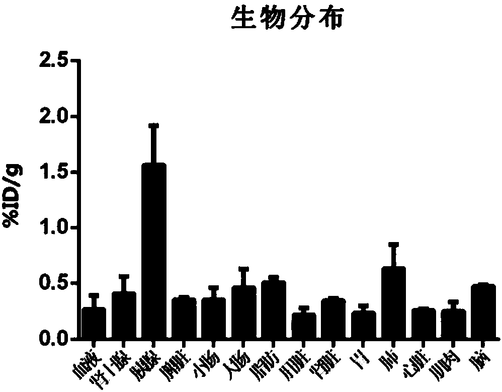 Radioactive molecular probe and application thereof in detection of living pancreas islets