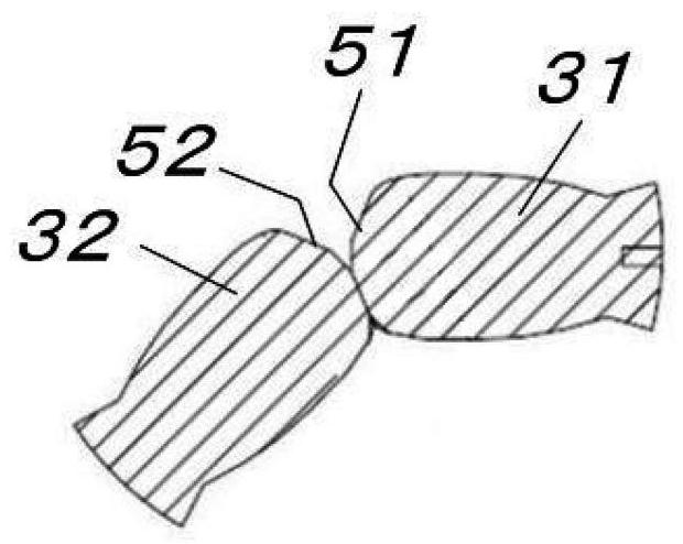 Acupuncture needle and method for forming acupuncture needle